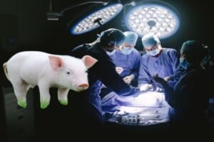 World First Pig Liver Transplanted in Human