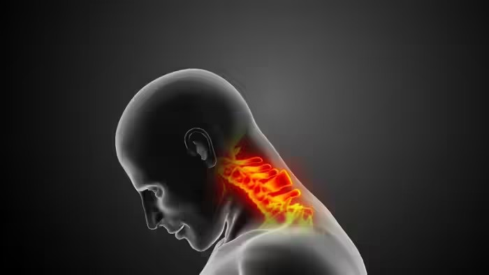 Cervical Spondylosis Symptoms